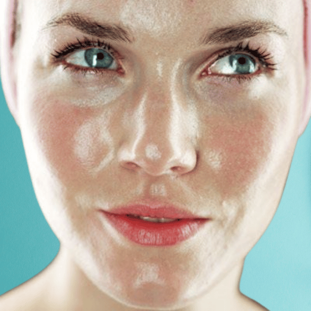 Oily Skin