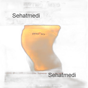 Orthomed Knee Support Size Medium