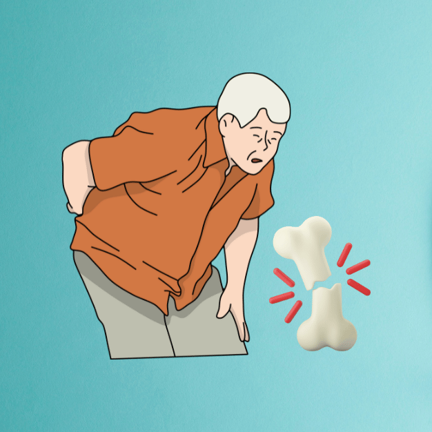 Osteoporosis