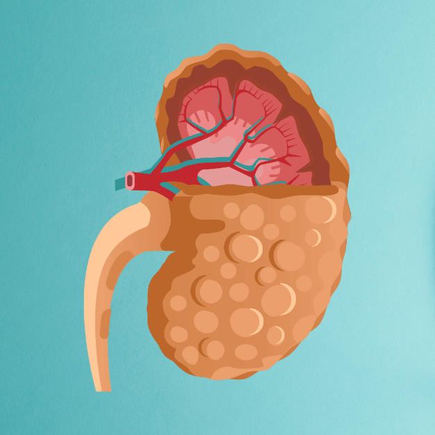 Pyelonephritis