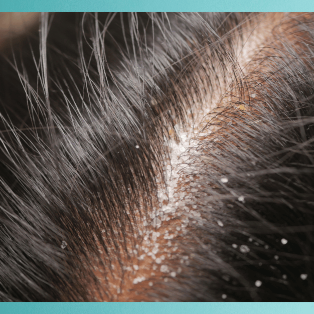 Shop by Hair Concern