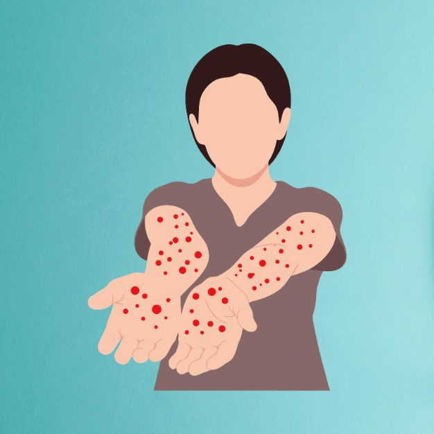 Viral Infections