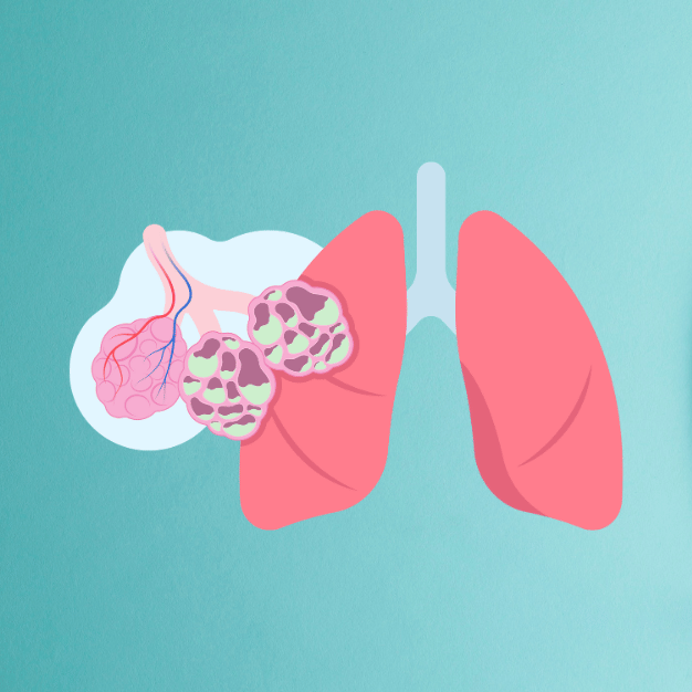 chronic obstructive pulmonary disease.